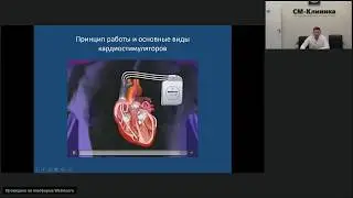 Запись вебинара «Нарушения ритма сердца» - Сидельников А.В. (14.08.2018)