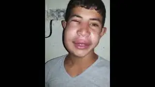 شاب يتعرض لهجوم النحل انضر ماذا فعلو به/اشبع ضحك😂😂