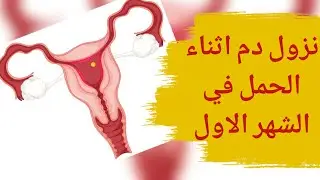 نزول دم اثناء الحمل في الشهر الاول متي يكون النزيف خلال الحمل طبيعيا ومتي خطرا ؟nozol dam fi chahr 1