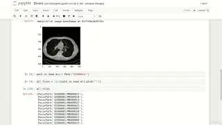 3  DICOM in Python