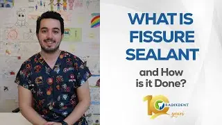What is fissure sealant and how is it done?