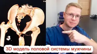 Computer tomography (CT): 3D model of the male reproductive system / Dr. Cherepanov