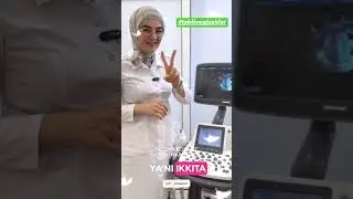 Tabiiy egizaklar