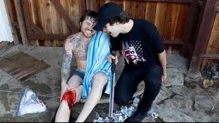 REAL LIFE FRUIT NINJA ACCIDENT!!