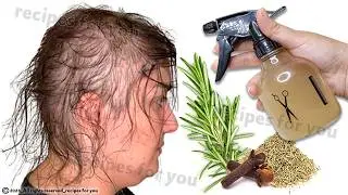 🌿 Hair Growth Like Crazy in Just 2 Days! ✨ Stop Hair Fall Fast with This Powerful Natural Spray 💧