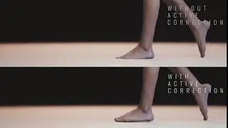 Unreal Engine Animation clipping Correction