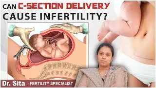 Can C-Section Cause Infertility? | Complications of C-Section | Dr. Sita Garimella | Boon Fertility