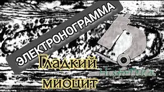 ГЛАДКИЙ МИОЦИТ (электронограмма)