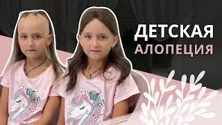 Детская алопеция..