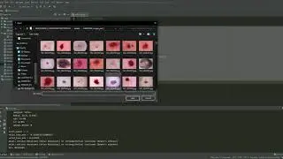 SKIN DISEASE CLASSIFICATION using PYTORCH | Machine Learning | Project | Python Language