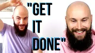GOING BALD YOUNG - *HAIR LOSS IS AN EXCUSE* - Baldcafe podcast Episode 12