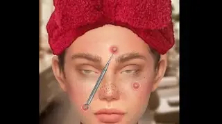 ASMR #asmr problem skin😪#problemskin