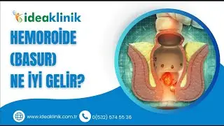 Basura (Hemoroid) Ne İyi Gelir?