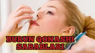 Burun qonashi xaqida malumot