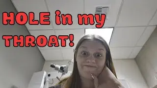 BOTCHED Surgery?!?