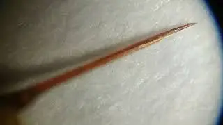 ЖАЛО ПЧЕЛЫ ПОД МИКРОСКОПОМ.