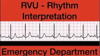 can you bill for rhythm strip interpretation in the emergency department?