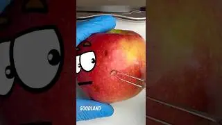 Goodland | Apple surgery 😳