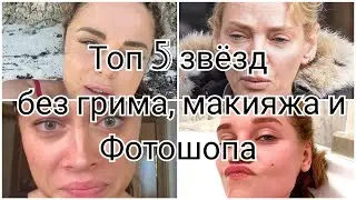 Как выглядят звёзды без фотошопа, грима и макияжа