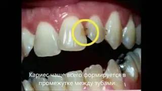 Чистка зубов и уход за ними. Как правильно присматривать зубы?