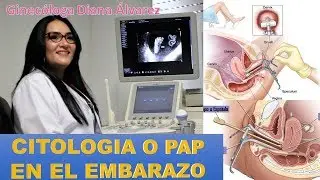 Vaginal Cytology and Ultrasound During Pregnancy: Myths and Facts by Gynecologist Diana Alvarez