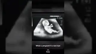 When a girl get pregnant for a taxi man