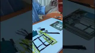Ulnar Dijital Sinir Yaralanması