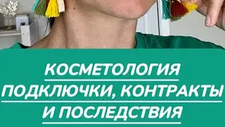 КОСМЕТОЛОГИЯ. ПОДКЛЮЧКИ, КОНТРАКТЫ И ПОСЛЕДСТВИЯ.