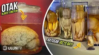 From Albert Einstein's Brain to a Baby's Fetus, This is a Museum That Holds Creepy & Terrifying T...