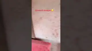 Дачный лазарет🤣