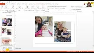 Современные методы профилактики кариеса  раннего возраста у детей с  синдромом Дауна