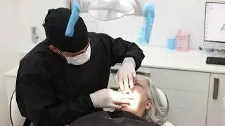 Dental Implants success story at All On X Dental Studio
