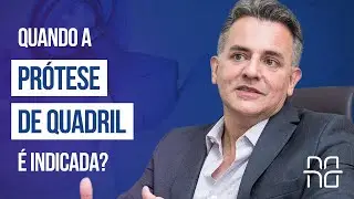 INDICAÇÕES PARA PRÓTESE DE QUADRIL
