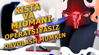 БЕМОРДА МИОМА КАСАЛЛИГИДАН ОЛИНГАН НАТИЖАНИ КУ́РИНГ КИСТА МИОМАНИ БЕЗ АПЕРАЦИЯСИЗ ДАВОЛАШ