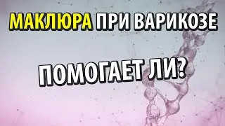 Помогает ли маклюра (адамово яблоко) при варикозе
