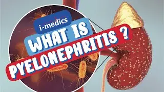What is Pyelonephritis?👨‍⚕️🩺
