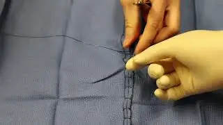 Endling the Lembert Pattern