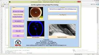 Iris Recognition and Classification Using Image Processing Matlab Project with Source Code
