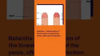 Understanding Penile Diseases Common Conditions & Expert Treatment  Kamakhya Andro-Uro Care