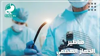 ايه هو منظار المعدة ؟ دكتور هاني  #اكسبلور #دكتور_هاني_علي #الام_المعدة #السعودية #ارتجاع_المريء علي