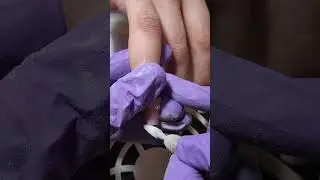 как же их снять?