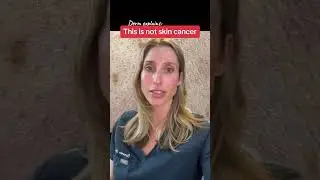 Do you have this skin growth? 