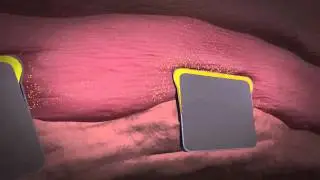 FullComboAnimation_2011.flv