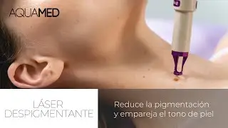 #Despigmentante | Atenúa las manchas de tu rostro con láser