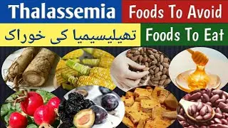 Thalassemia Foods To Avoid & Eat | تھیلیسیمیا کی خوراک | Thalassemia Diet Plan At Home