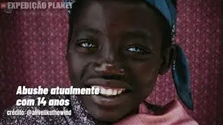 Apenas 1% das pessoas possui essa cor de olhos