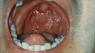 Me swallowing another big orange whole