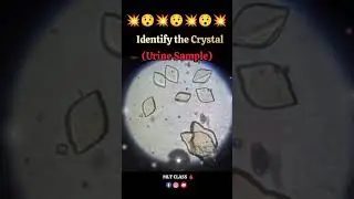 Identify the Crystal(URINE SAMPLE)🔬💥💯