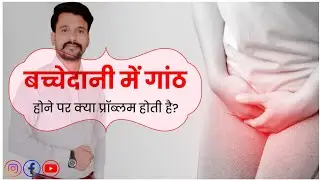 Fibroids Uterus fibroid | बच्चेदानी में गांठ या रसौली के कारण, लक्षण #Uterine #uterinefibroids