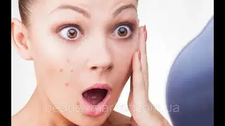 Продукция NSP.  Результаты. ДИАТЕЗ и АКНЕ.